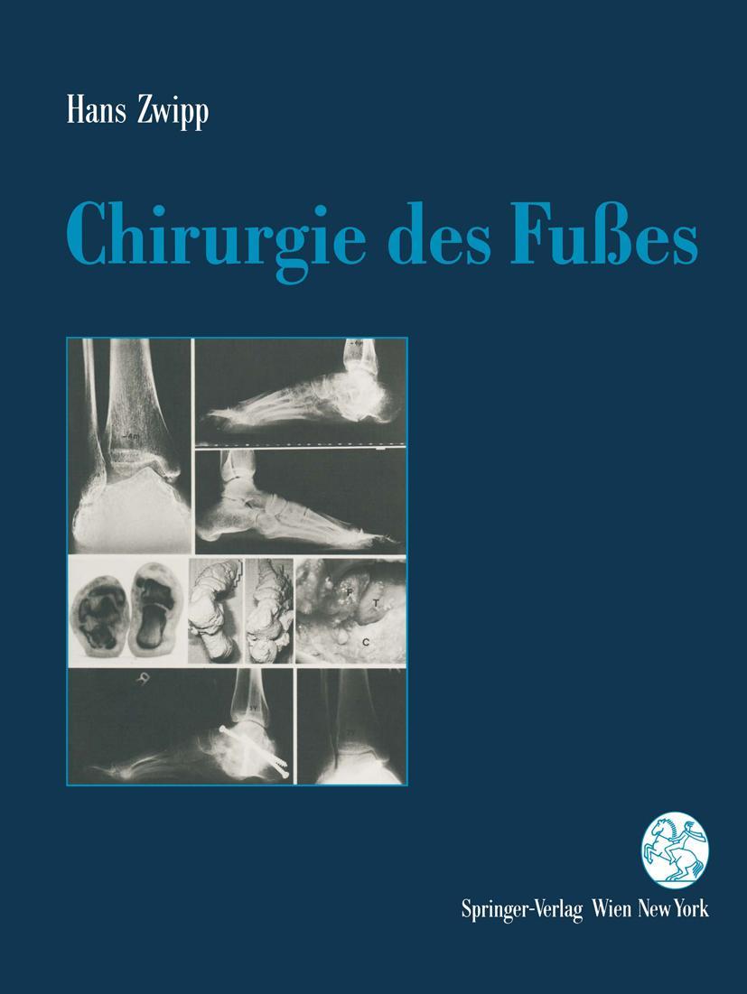 Vorderes Coverbild Chirurgie des Fußes