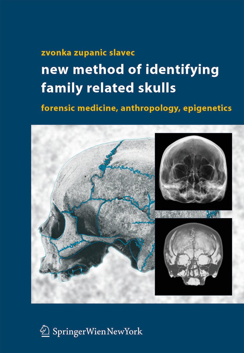 Vorderes Coverbild New Method of Identifying Family Related Skulls