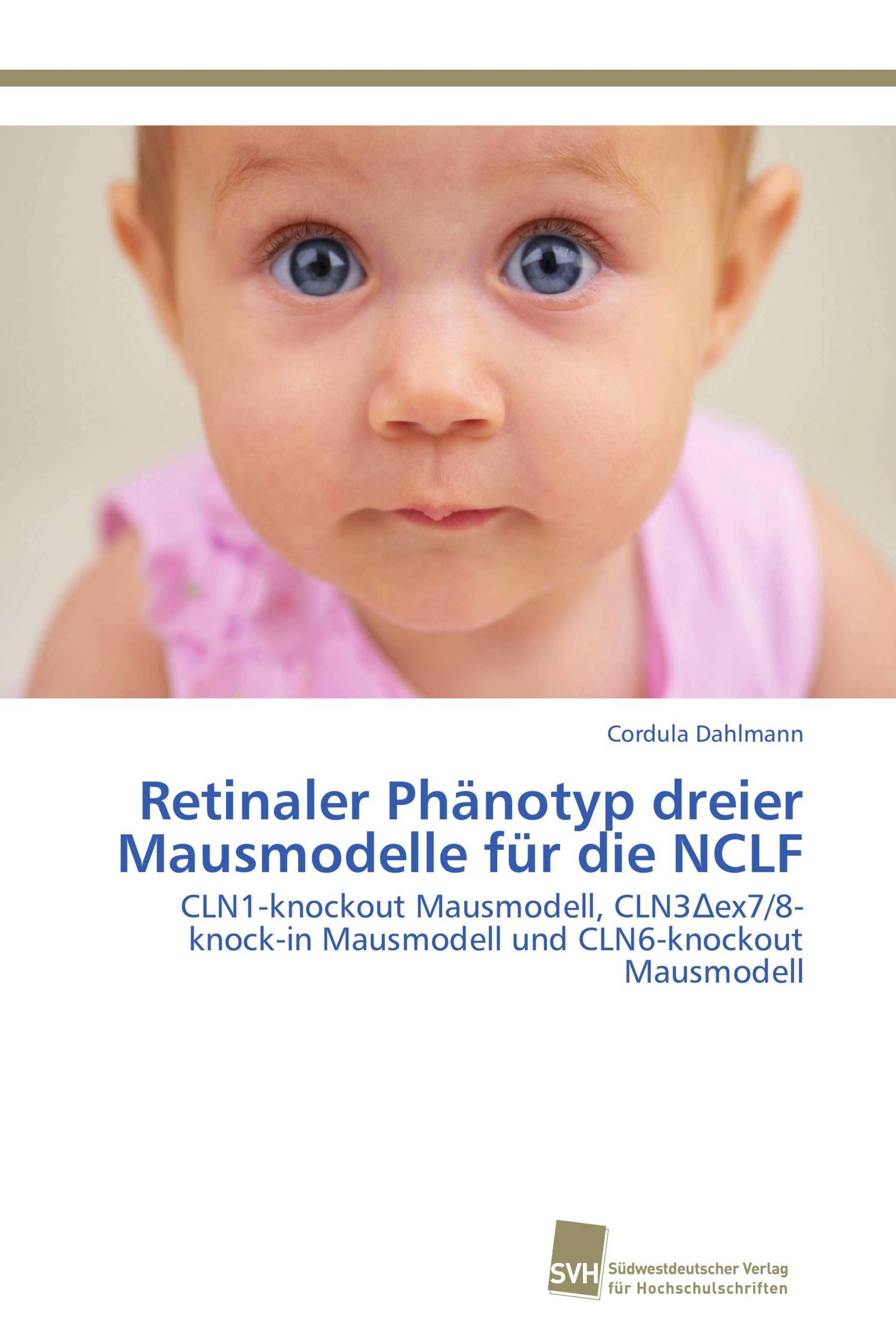 Vorderes Coverbild Retinaler Phänotyp dreier Mausmodelle für die NCLF