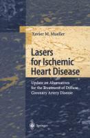 Vorderes Coverbild Lasers for Ischemic Heart Disease