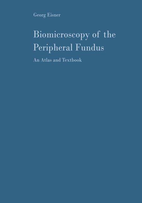 Vorderes Coverbild Biomicroscopy of the Peripheral Fundus