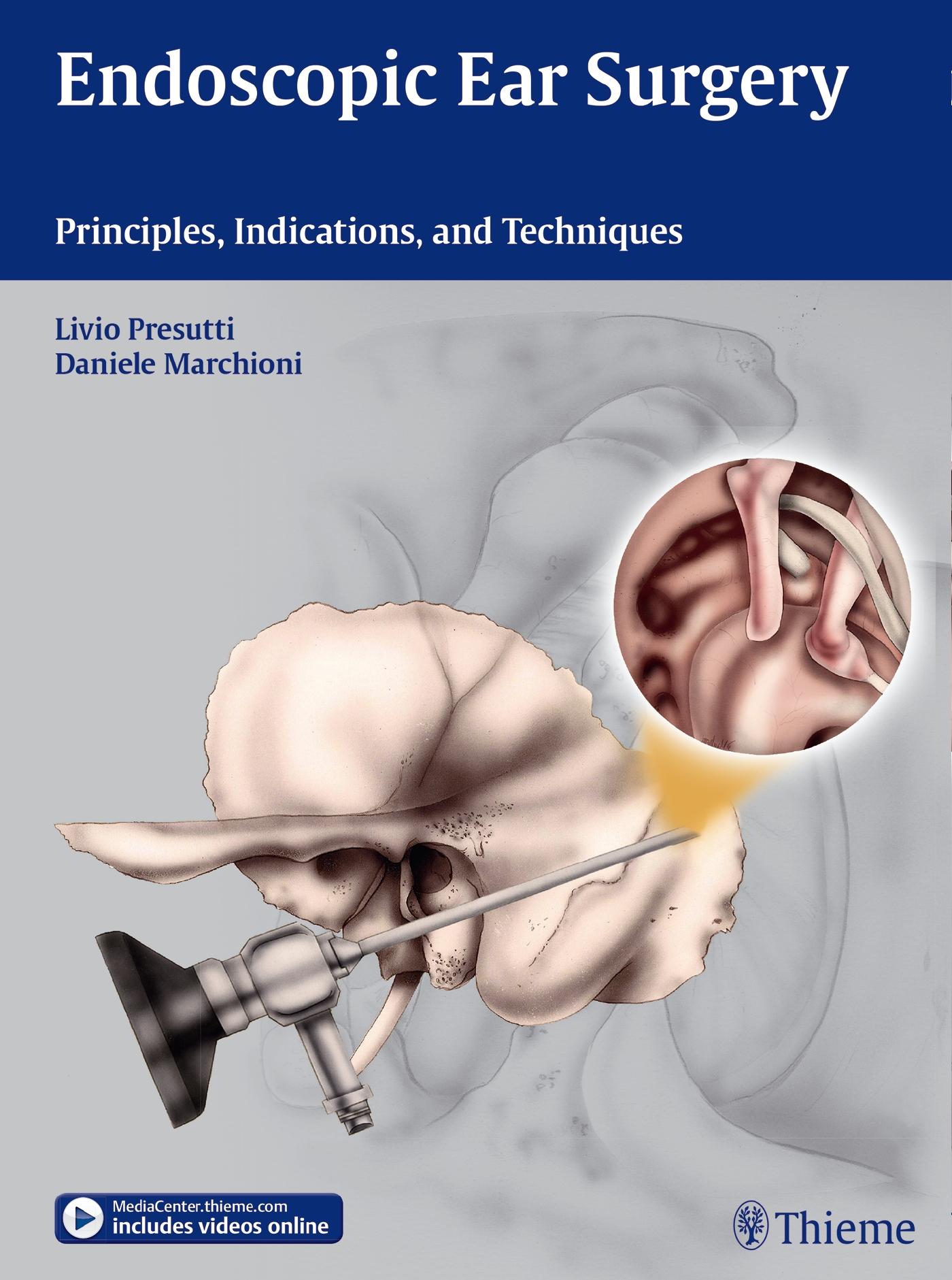 Vorderes Coverbild Endoscopic Ear Surgery