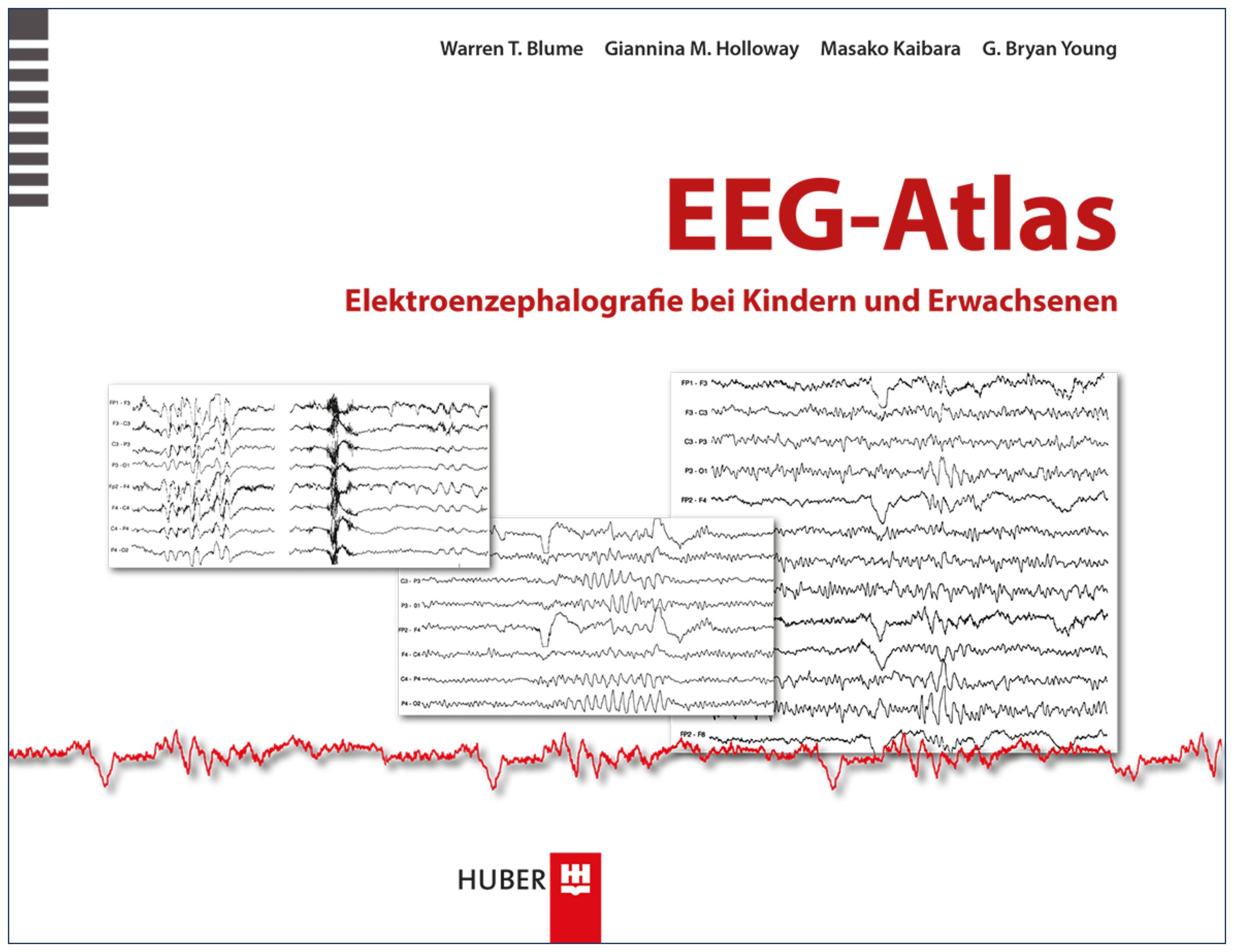 Vorderes Coverbild EEG-Atlas