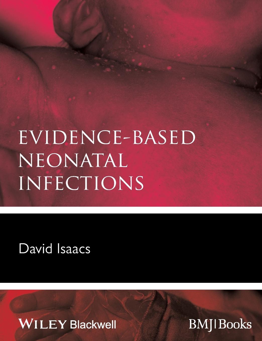Vorderes Coverbild Evidence-Based Neonatal Infections