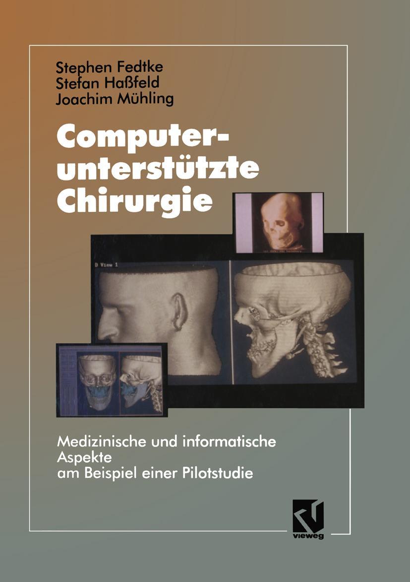 Vorderes Coverbild Computerunterstützte Chirurgie