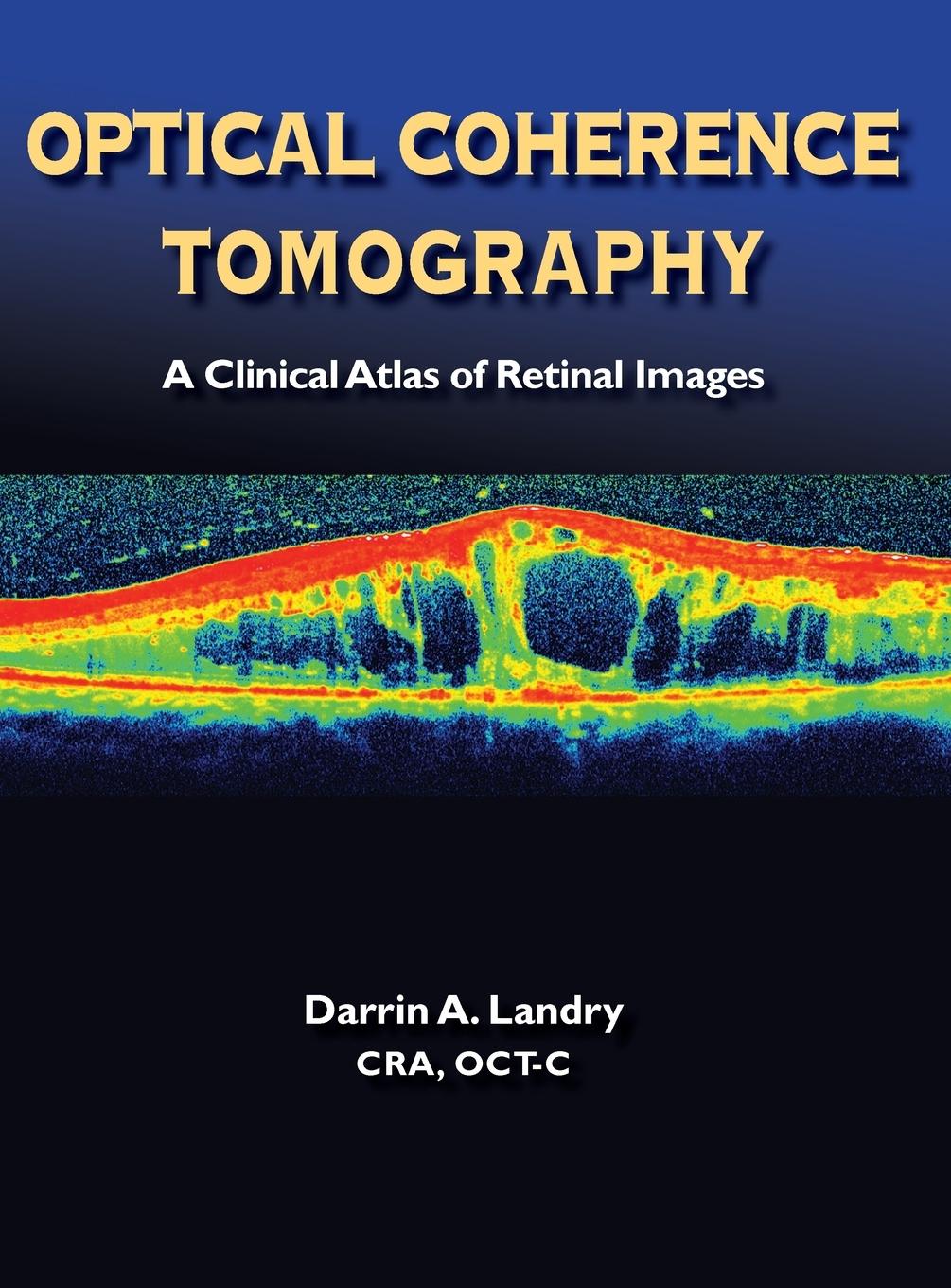 Vorderes Coverbild Optical Coherence Tomography