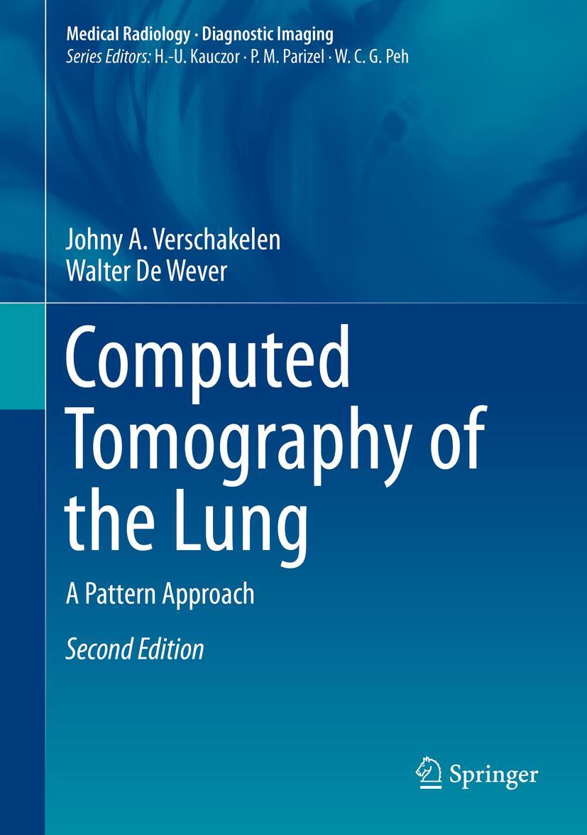 Vorderes Coverbild Computed Tomography of the Lung
