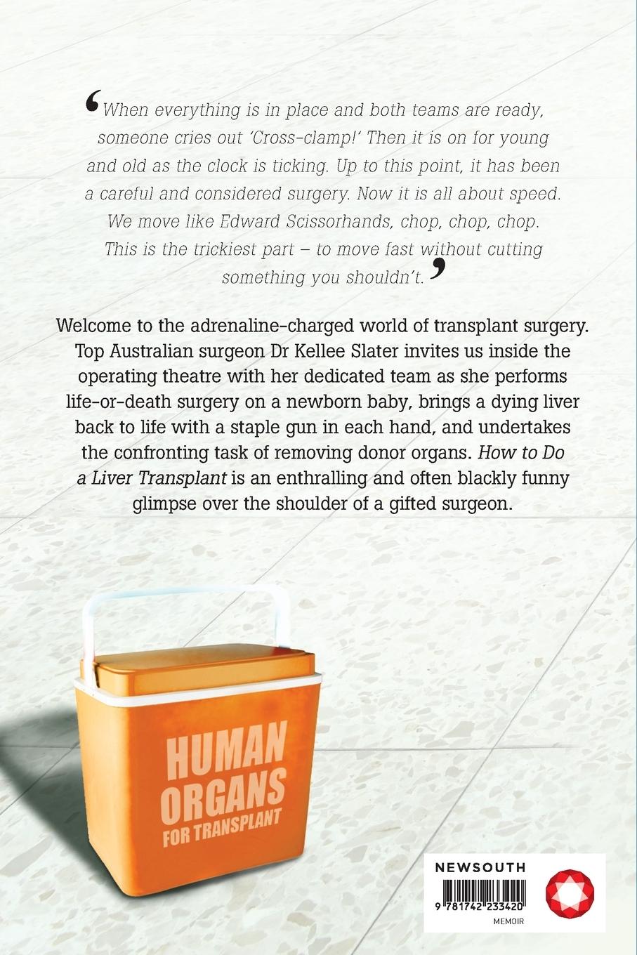 Rückseitencover How to do a liver transplant