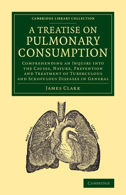 Vorderes Coverbild A   Treatise on Pulmonary Consumption