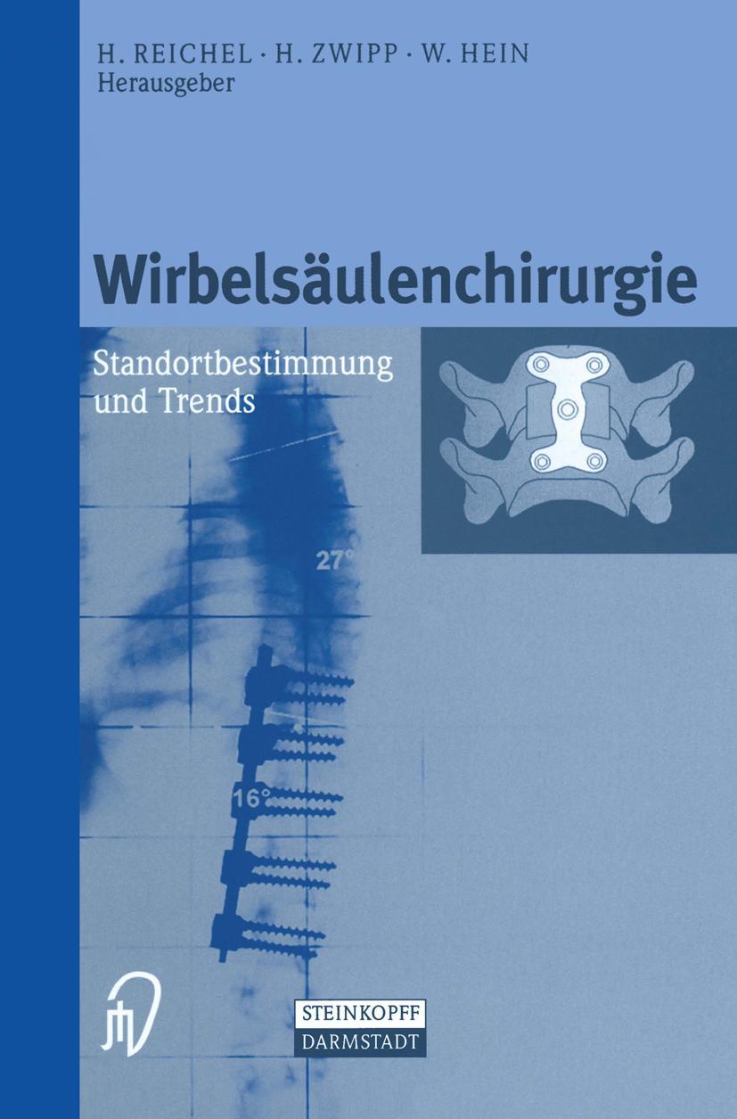 Vorderes Coverbild Wirbelsäulenchirurgie