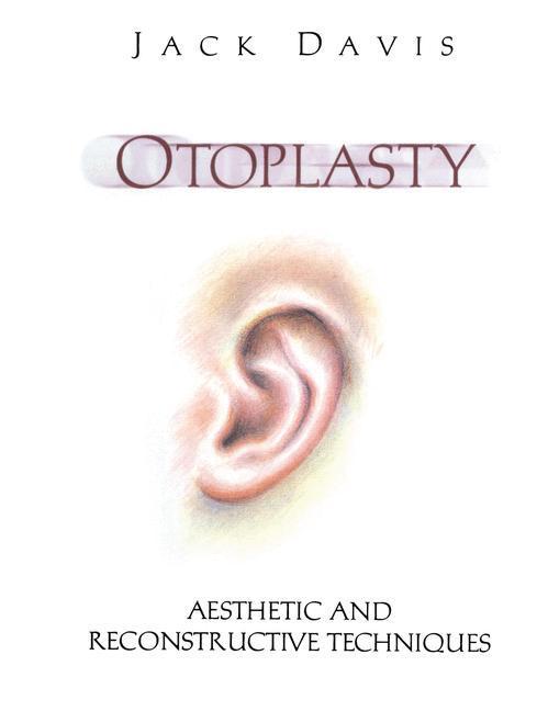 Beispielinhalt (Bild) Otoplasty