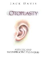 Vorderes Coverbild Otoplasty