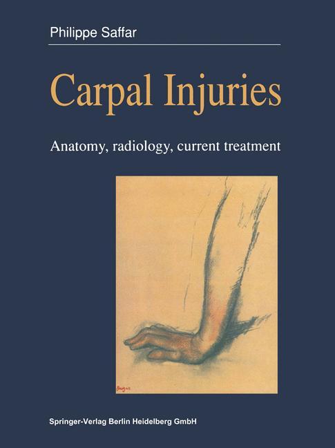 Vorderes Coverbild Carpal injuries
