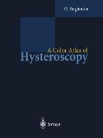 Vorderes Coverbild A Color Atlas of Hysteroscopy