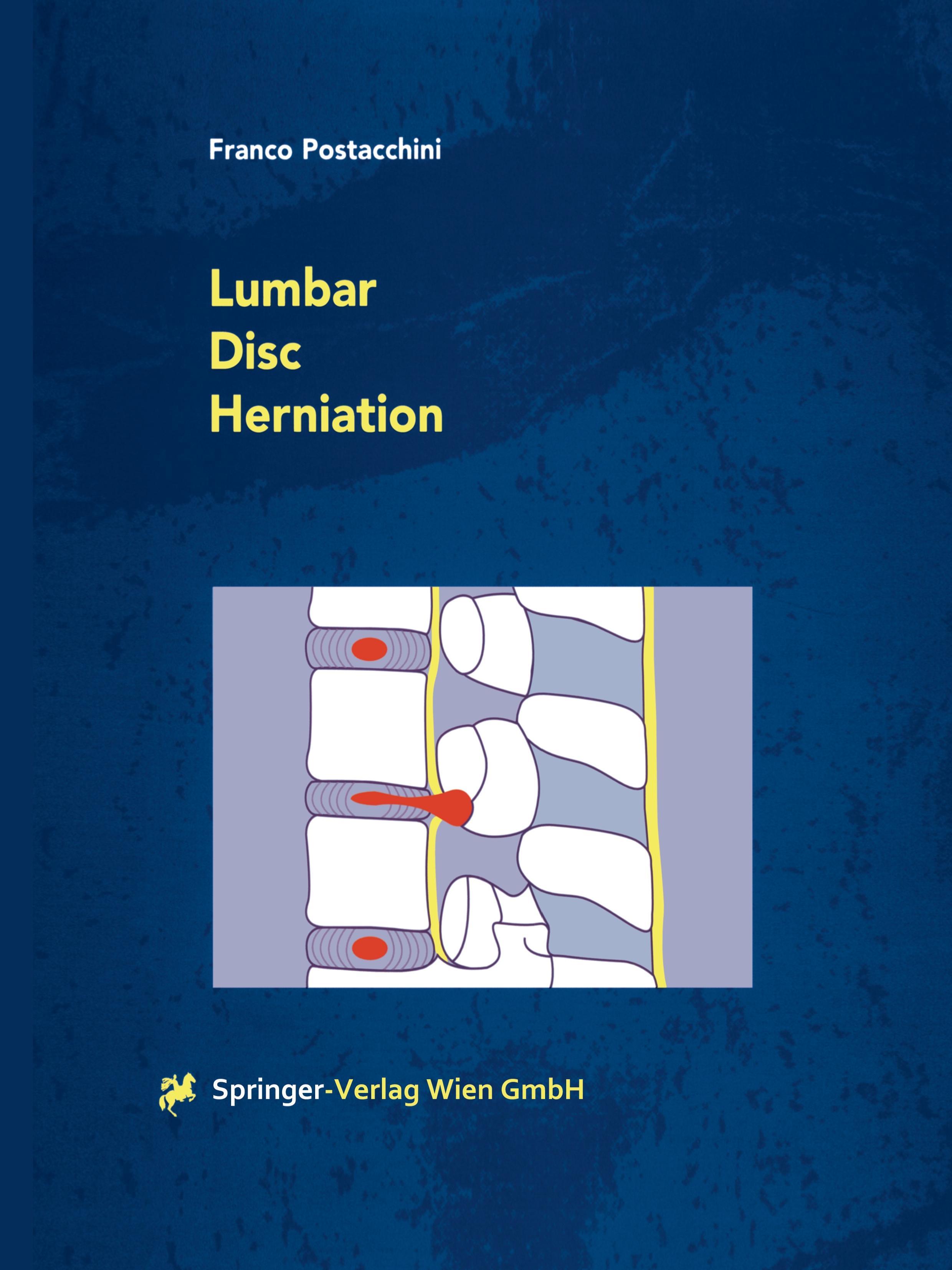 Vorderes Coverbild Lumbar Disc Herniation