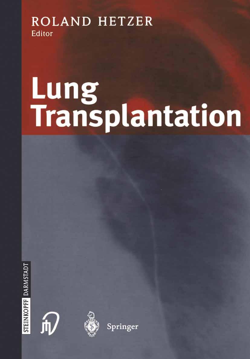 Vorderes Coverbild Lung Transplantation