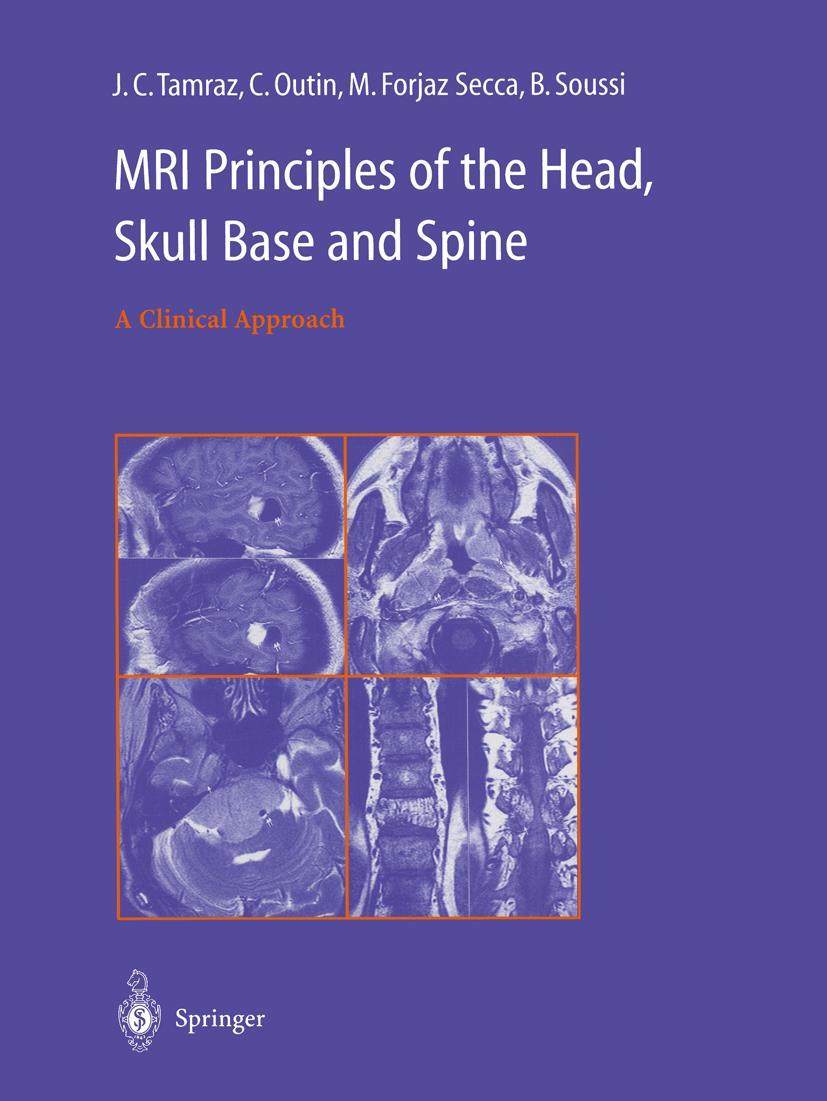 Vorderes Coverbild MRI Principles of the Head, Skull Base and Spine