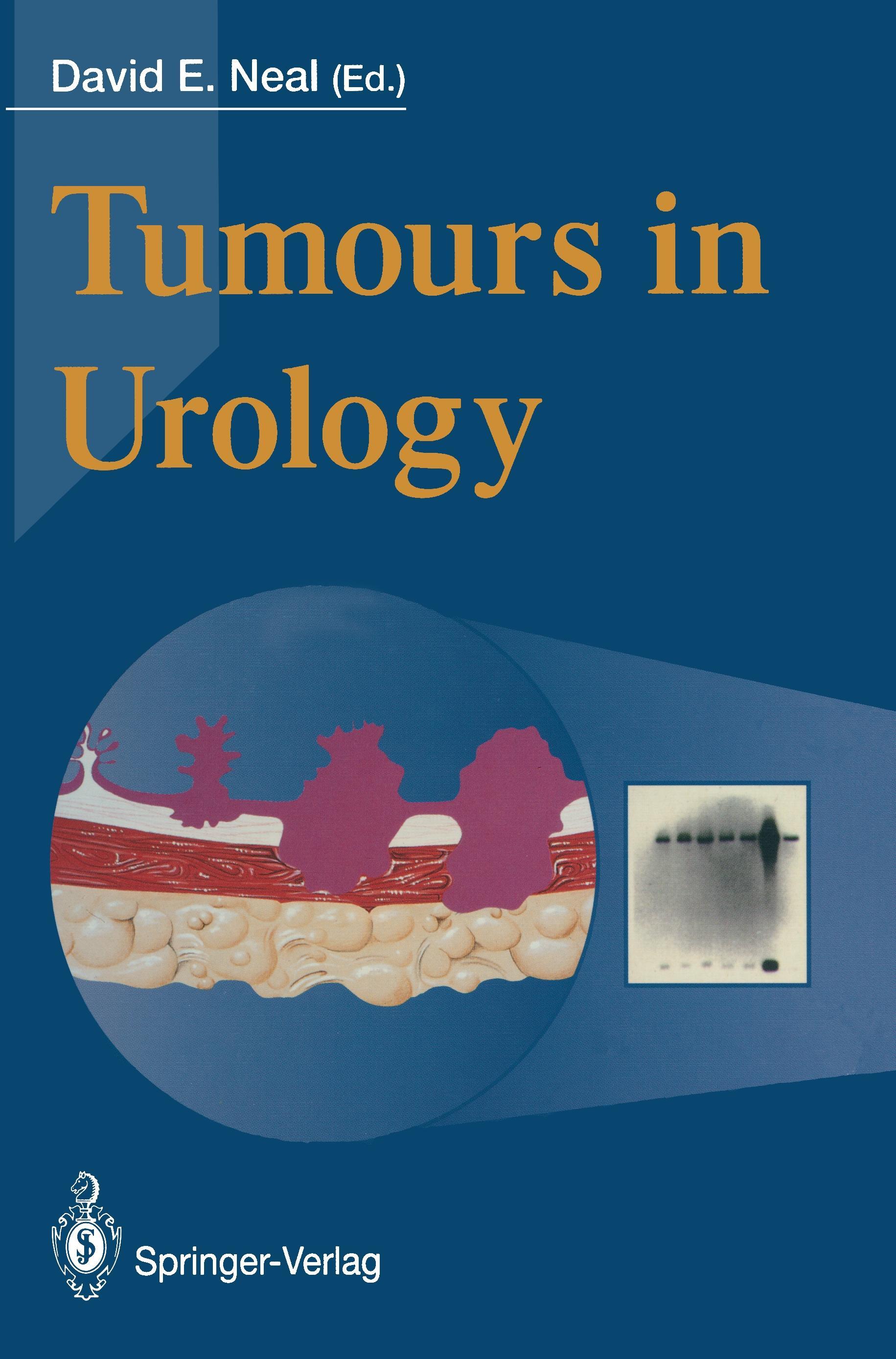 Vorderes Coverbild Tumours in Urology