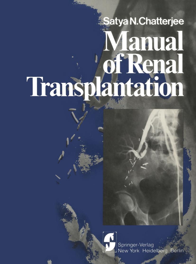 Vorderes Coverbild Manual of Renal Transplantation