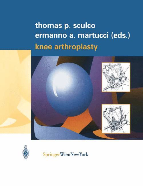 Vorderes Coverbild Knee Arthroplasty