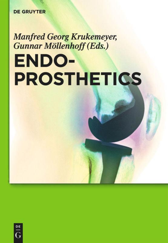 Vorderes Coverbild Endoprosthetics