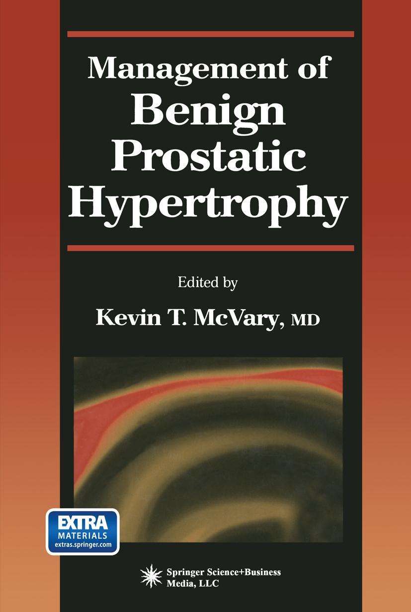 Vorderes Coverbild Management of Benign Prostatic Hypertrophy