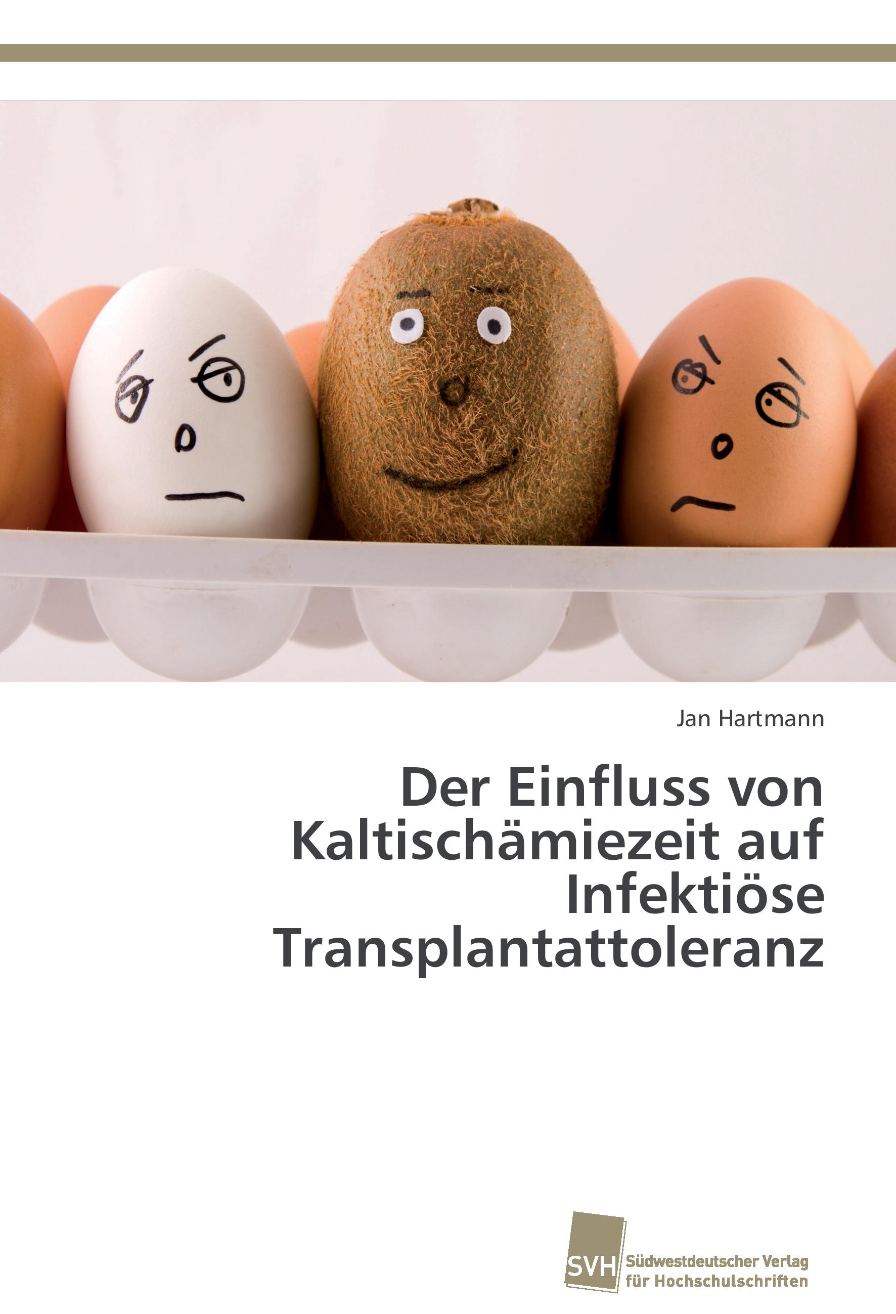 Vorderes Coverbild Der Einfluss von Kaltischämiezeit auf Infektiöse Transplantattoleranz