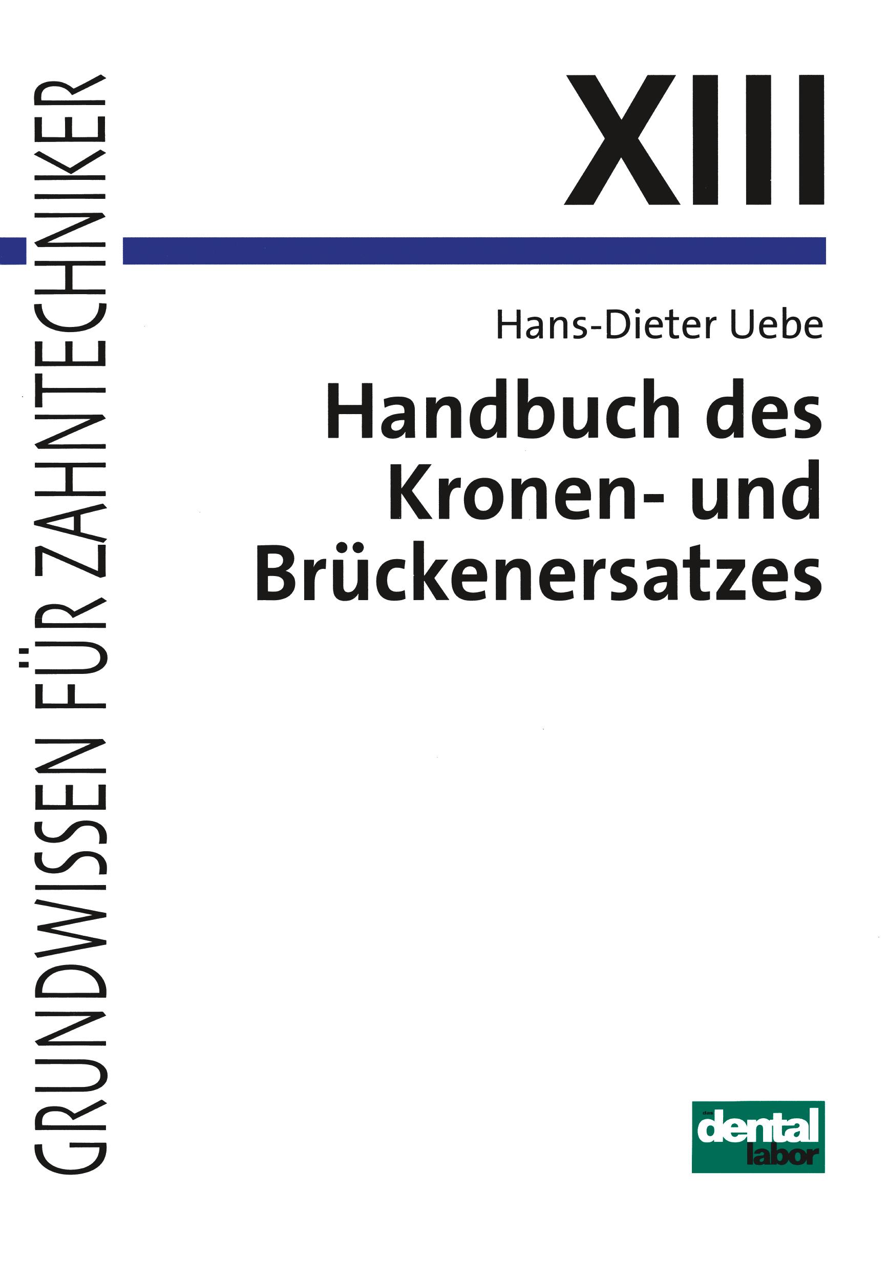 Vorderes Coverbild Handbuch des Kronen- und Brückenersatzes