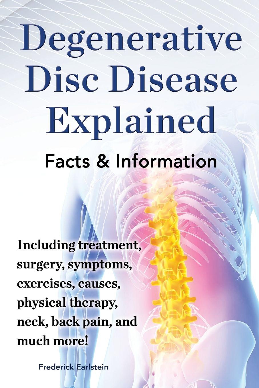Vorderes Coverbild Degenerative Disc Disease Explained. Including Treatment, Surgery, Symptoms, Exercises, Causes, Physical Therapy, Neck, Back, Pain, and Much More! Fac