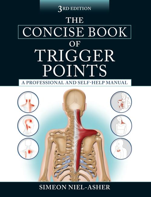Vorderes Coverbild The Concise Book of Trigger Points, Third Edition