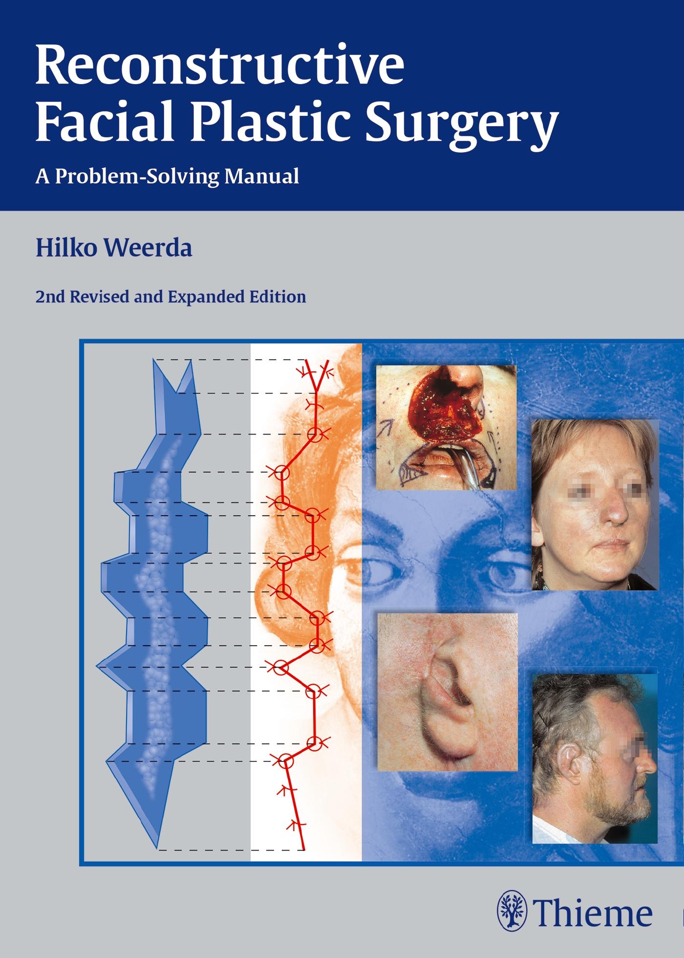 Vorderes Coverbild Reconstructive Facial Plastic Surgery