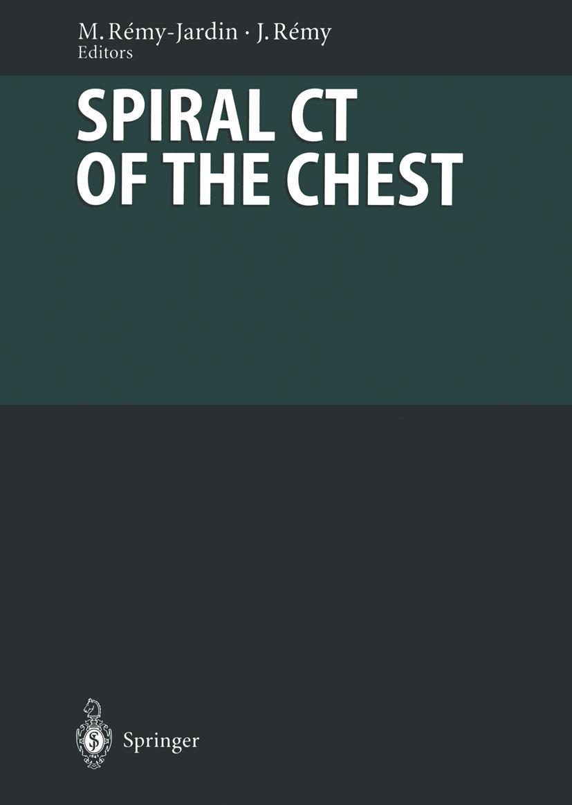 Vorderes Coverbild Spiral CT of the Chest