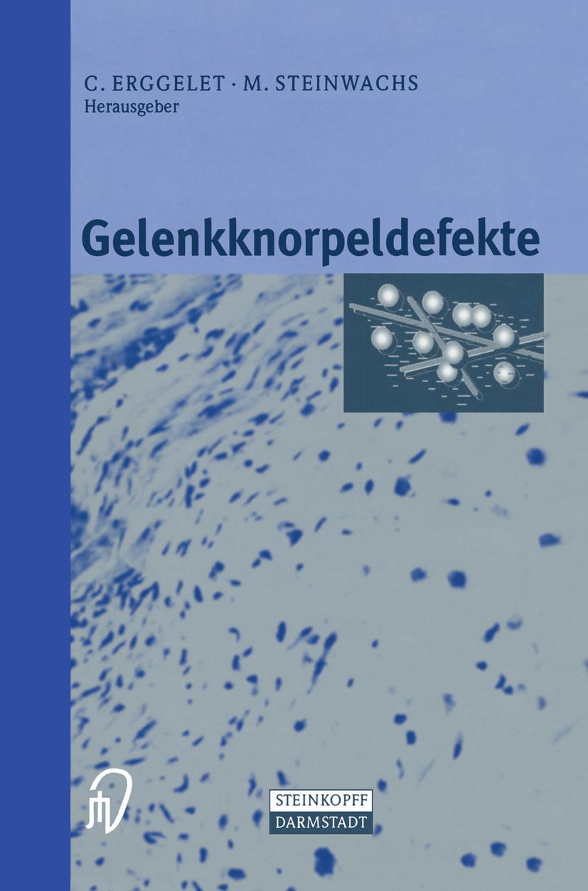 Vorderes Coverbild Gelenkknorpeldefekte