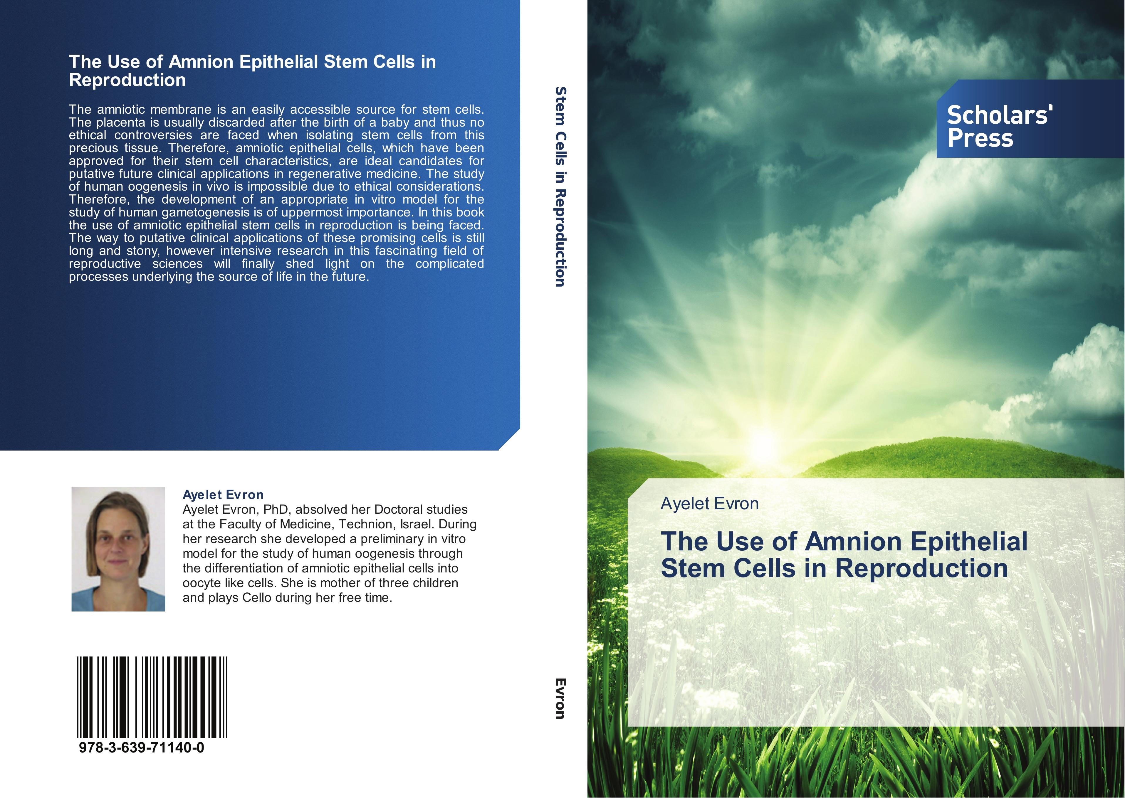Vorderes Coverbild The Use of Amnion Epithelial Stem Cells in Reproduction