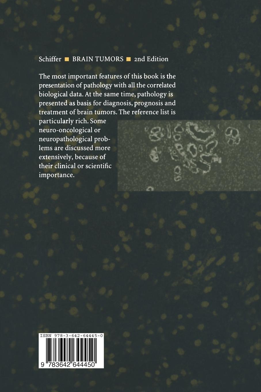 Rückseitencover Brain Tumors
