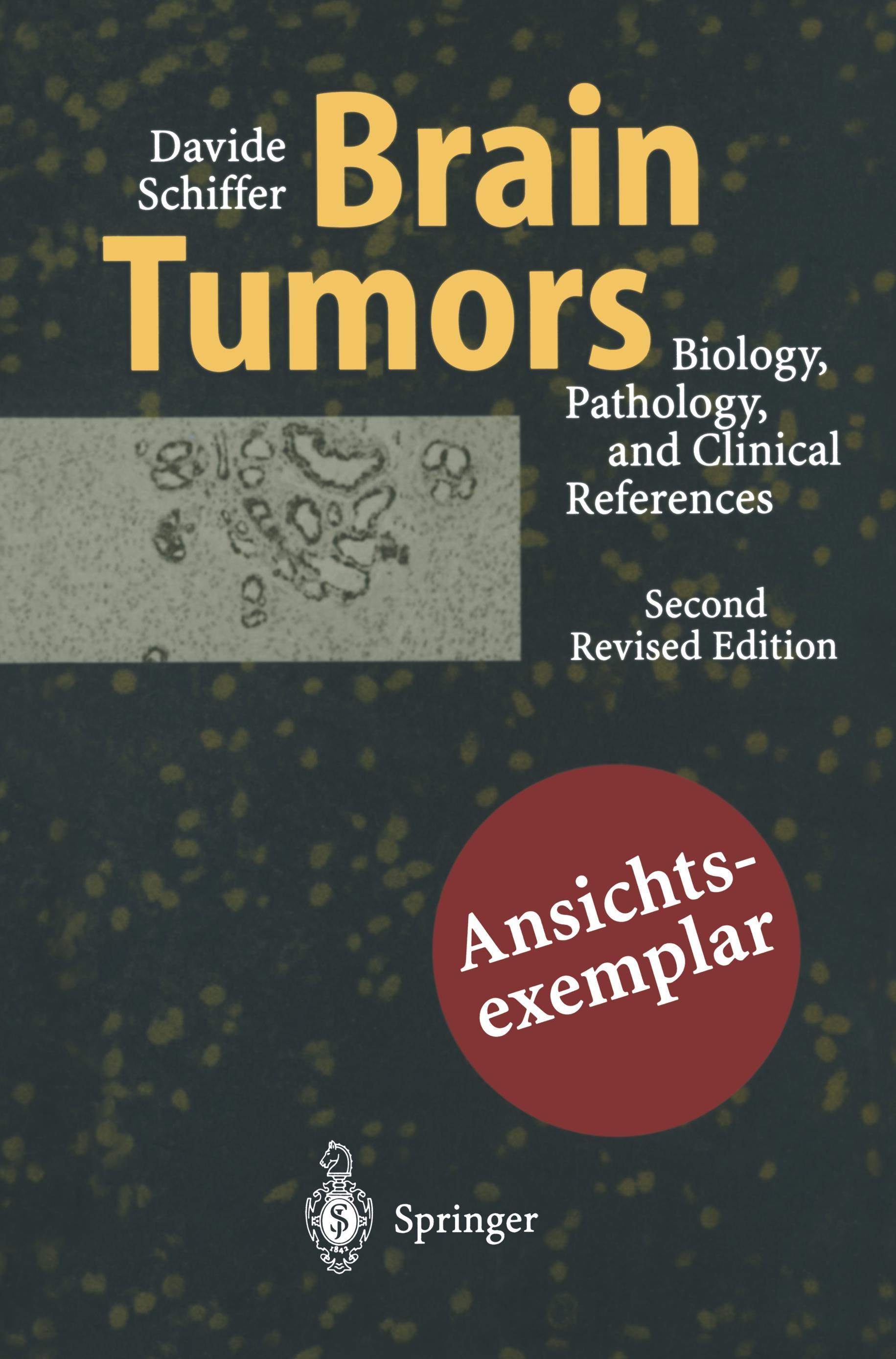 Vorderes Coverbild Brain Tumors