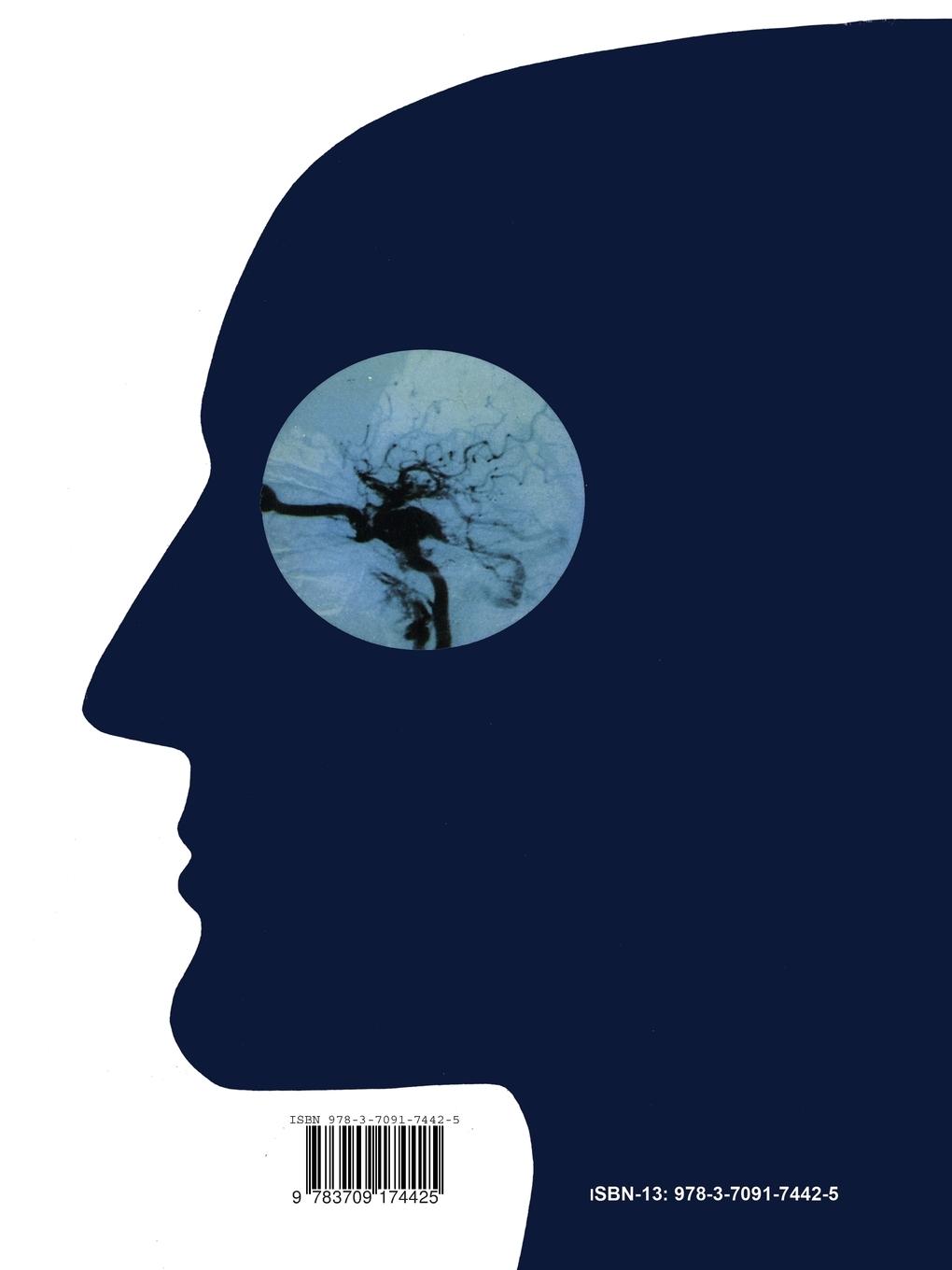 Rückseitencover Anatomy and Surgery of the Cavernous Sinus