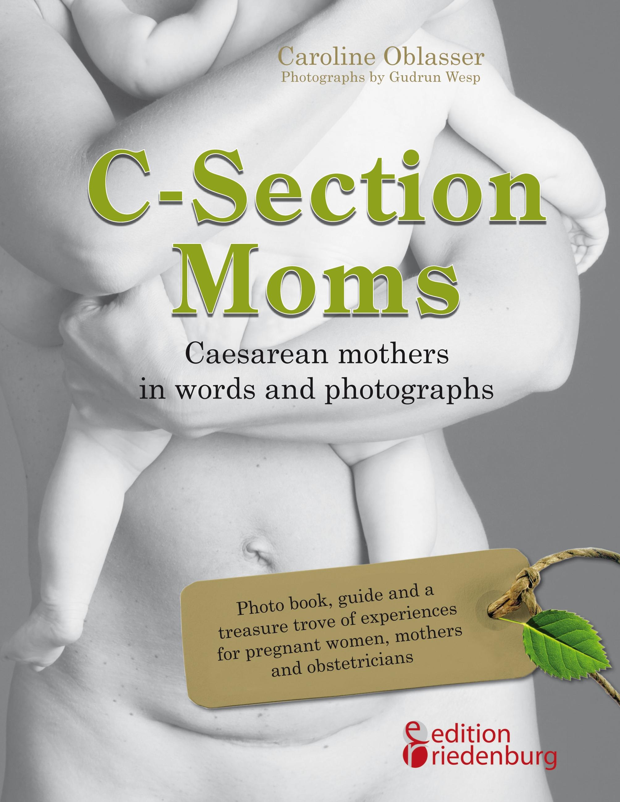 Vorderes Coverbild C-Section Moms - Caesarean mothers in words and photographs
