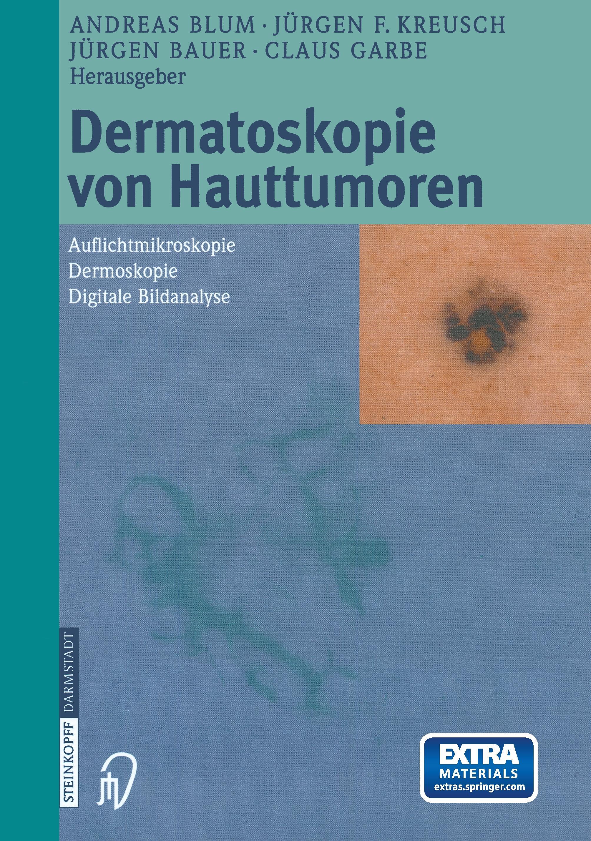 Vorderes Coverbild Dermatoskopie von Hauttumoren