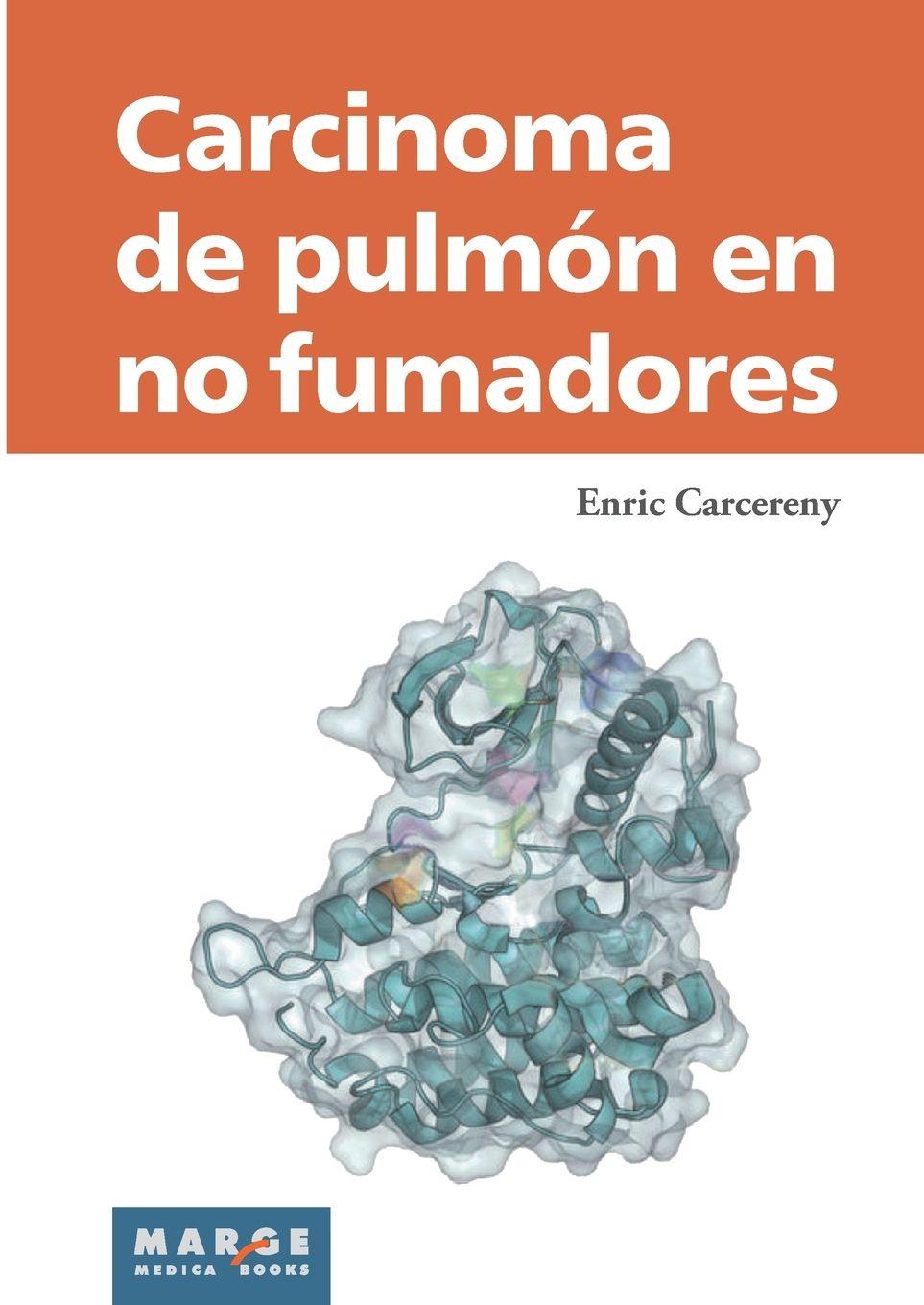 Vorderes Coverbild Carcinoma de pulmón en no fumadores