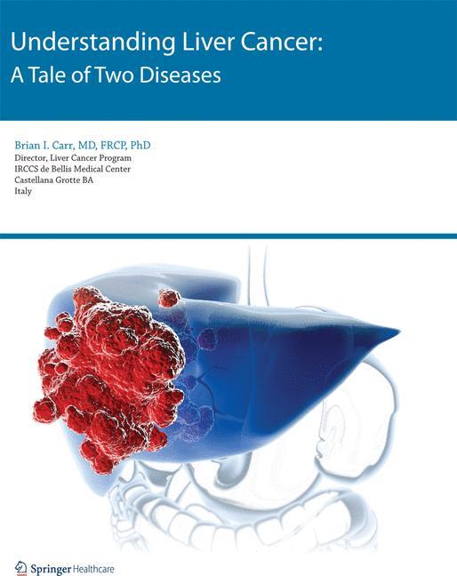 Vorderes Coverbild Understanding Liver Cancer