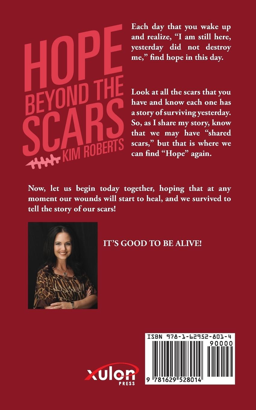 Rückseitencover Hope Beyond the Scars
