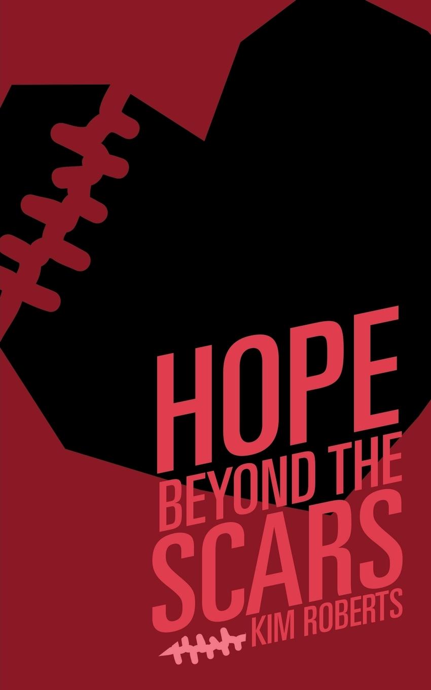 Vorderes Coverbild Hope Beyond the Scars