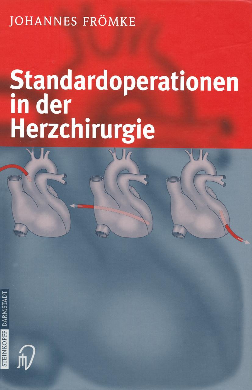 Vorderes Coverbild Standardoperationen in der Herzchirurgie