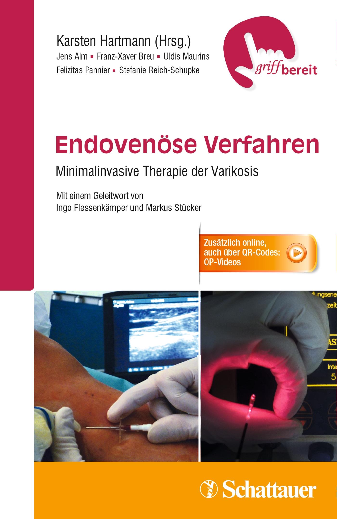 Vorderes Coverbild Endovenöse Verfahren