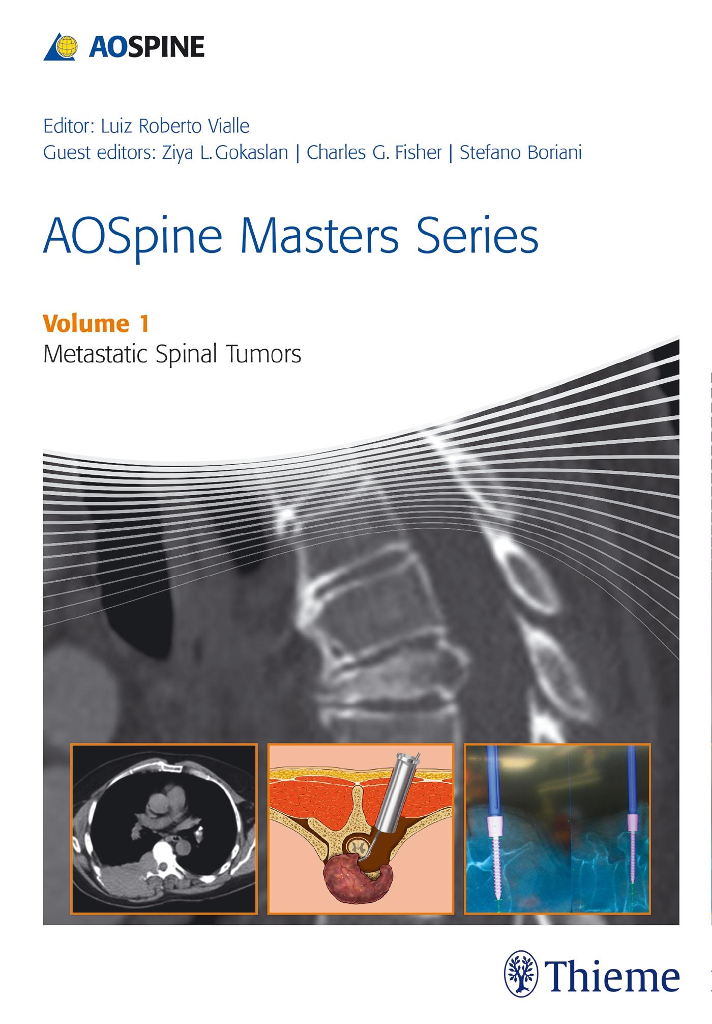 Vorderes Coverbild Aospine Masters Series Volume 1: Metastatic Spinal Tumors