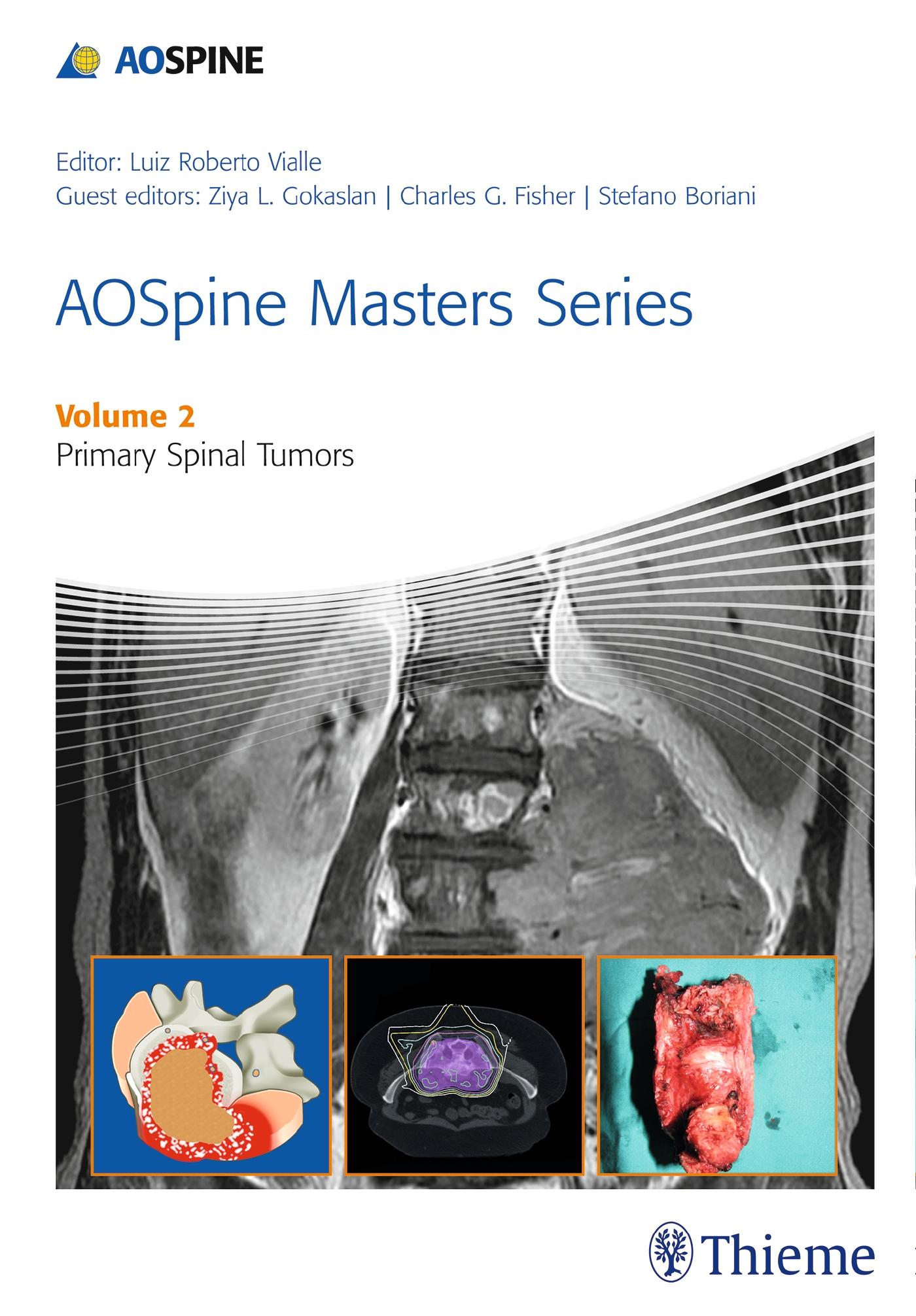 Vorderes Coverbild Aospine Masters Series Volume 2: Primary Spinal Tumors