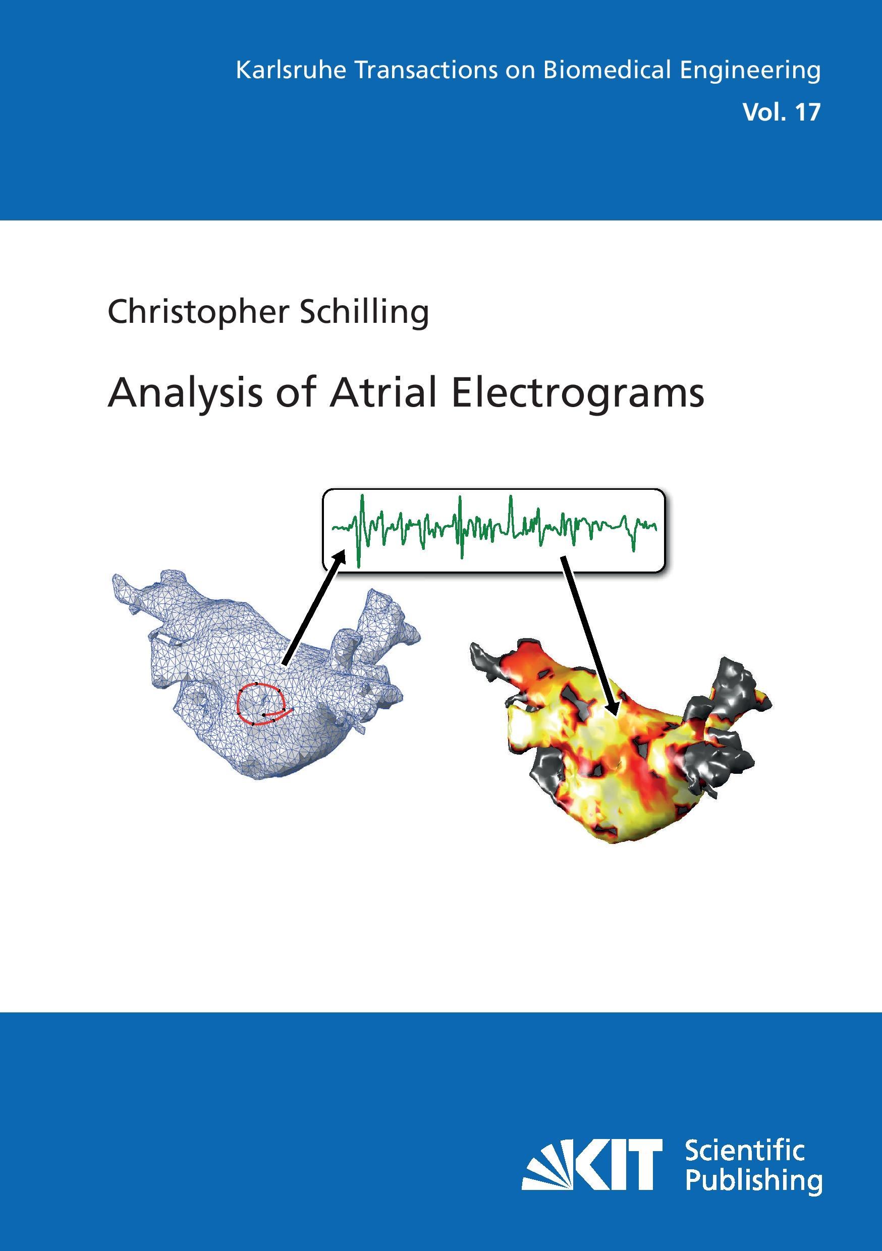 Vorderes Coverbild Analysis of Atrial Electrograms