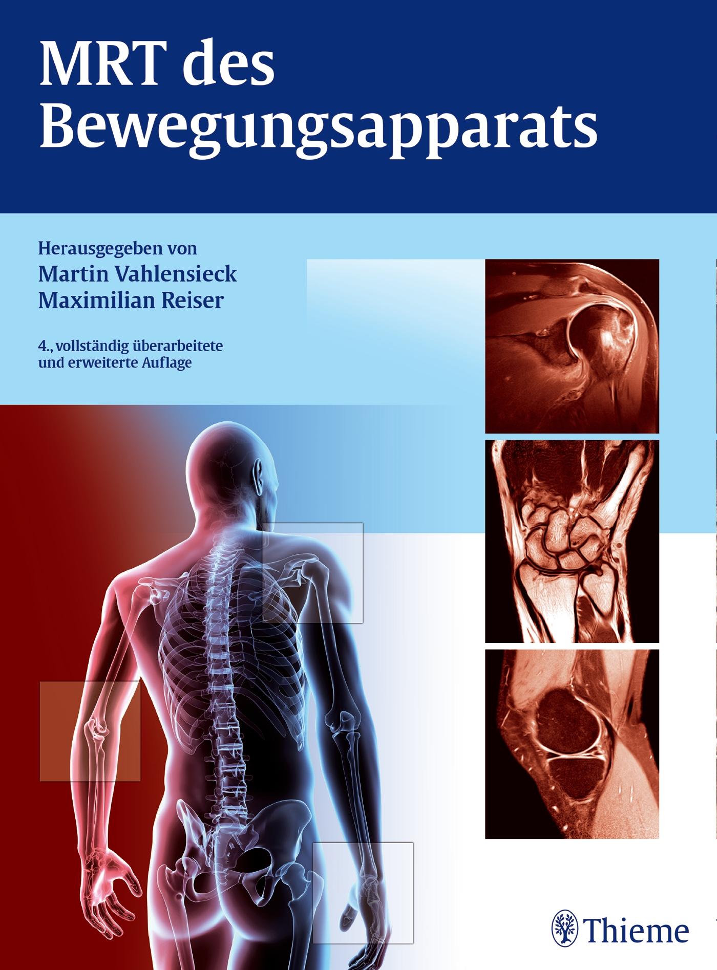 Vorderes Coverbild MRT des Bewegungsapparats