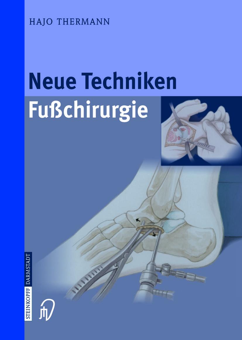 Vorderes Coverbild Neue Techniken Fusschirurgie